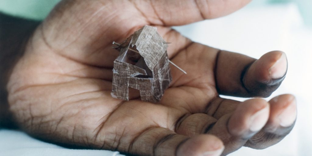Photograph of a black hand holding a small house, made of the artist's own skin grafts.